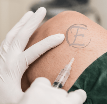 APLICAÇÃO DE ESCLEROTERAPIA