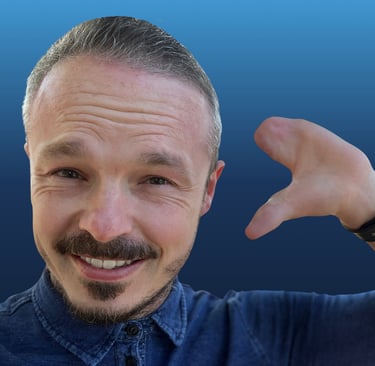 A white male holding up their upper limb difference