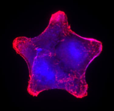 Metastatic Cancer Cell