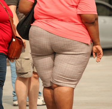 Obesity example