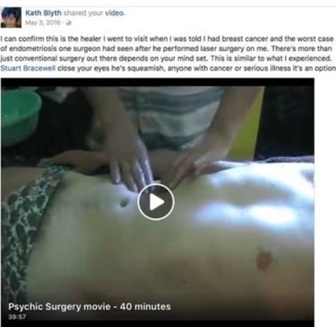 Psychic Surgery on Patrick