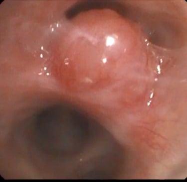 Bronchoscopy private service