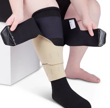 Lymphedema: patient wearing long-term compression garment to manage swelling.