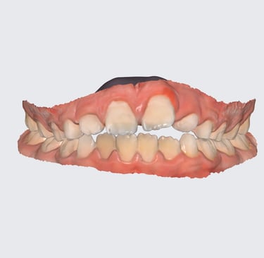 escaner dental para niños