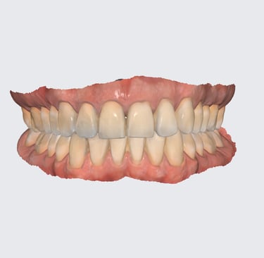 scan dental para adultos