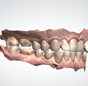 scaner dental para coronas