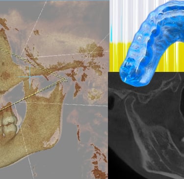 escaner dental y ATM