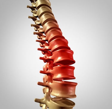 Ameliyatsız bel fıtığı tedavisi