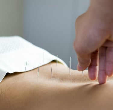 Akupunktur Tedavisi