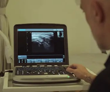 Evaluación Ecográfica