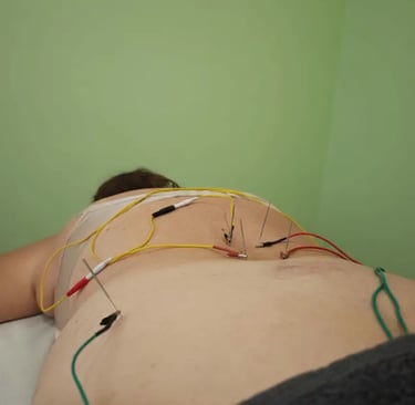 Neuromodulaci.on Fisioterapia Argoños