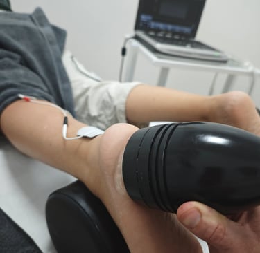 Ondas de choque focales para fascitis plantar en Argoños