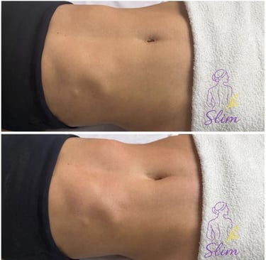 Drenagem linfática em São José do Rio Preto