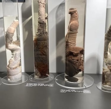 Anatomical specimens of whale penises preserved in liquid-filled glass jars at the Icelandic Phallological Museum.
