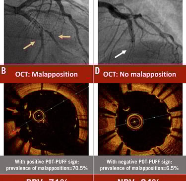 Eurointervention Aminfar et al