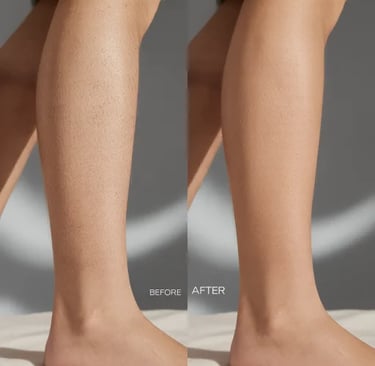 Protocolli epilazione laser personalizzati Lilium Palermo