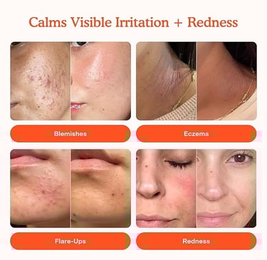 Minimalist graphic showing the spray’s key benefits including redness reduction, skin barrier suppor