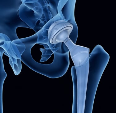 kinésithérapie orthopédique PTH