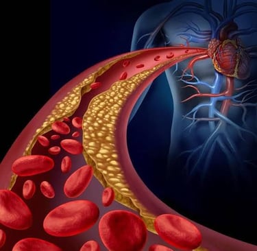 a blood clotsh and blood vessels in a vein