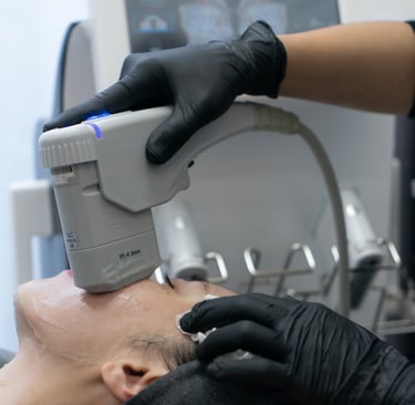 woman receiving HIFU treatment on cheek