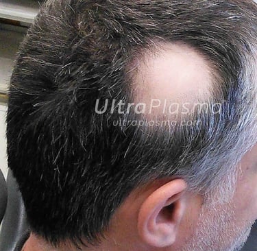 _ultra_plasma_ultra_plazma_ultra-plasma_ultra-plazma