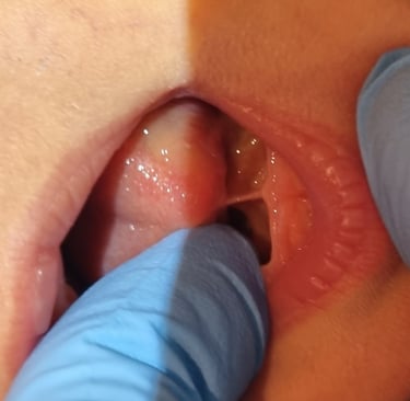 Baby with tongue-tie
