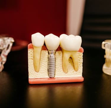 Zahnimplantate Türkei — Straumann Implantat Beratung bei Designed Smiles İzmir