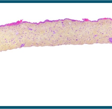 Histology cross-section of skin tissue biopsy with purple and yellow stain for cellular analysis.