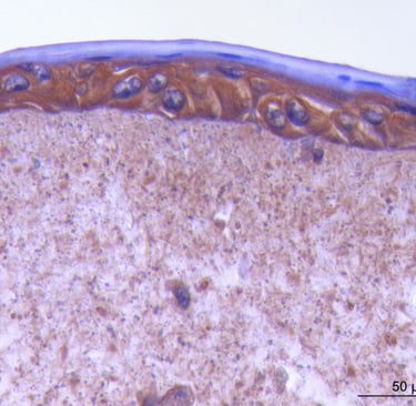 Microscopic view of skin tissue cross-section with epidermis and dermis layers at 50 micrometers.