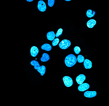 Fluorescence microscopy image showing glowing blue DAPI-stained cell nuclei, normal and toroidal.