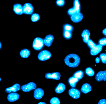 Fluorescence microscopy image showing glowing blue DAPI-stained cell nuclei, normal and toroidal.