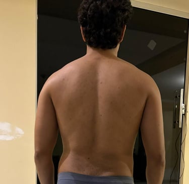 um homem com costas de poucos músculos