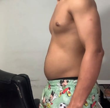 antes e depoiis falso magro