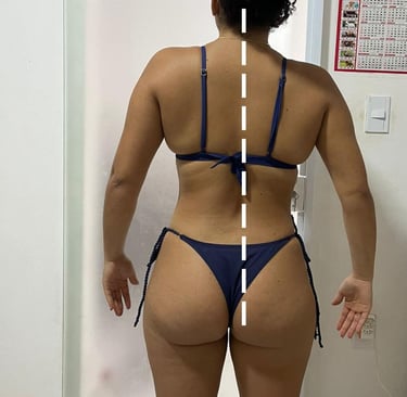 antes e depois postura torta