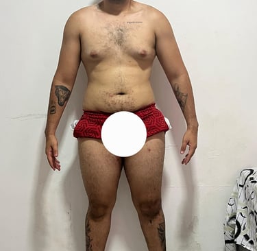 antes e depois acima do peso