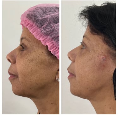 a woman with a pink hat and a pink hairband