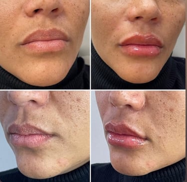 a woman with a lot of freckers on her lips