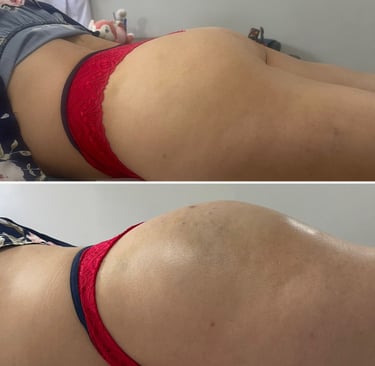 a woman with a red bikini top and a red bikini top