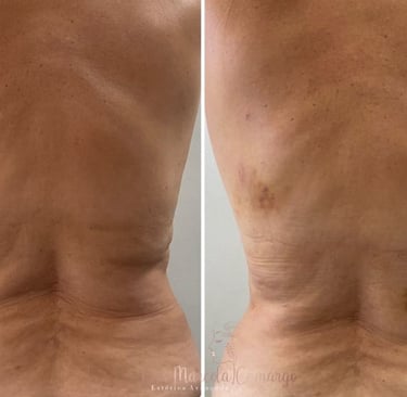 a man with a very large back and a very small back