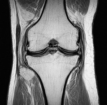 IRM du genou examen imagerie