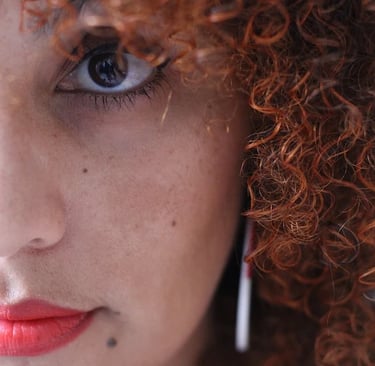 Melasma treatment at Ariana Esthetic Edmonton