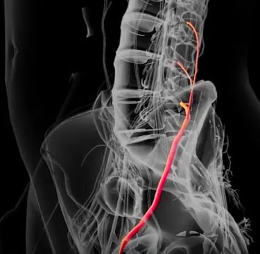 Stimulating the Femoral Nerve