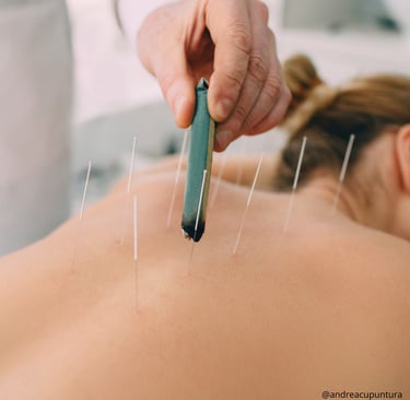 moxabustão, acupuntura, fertilidade, dor, enxaqueca
