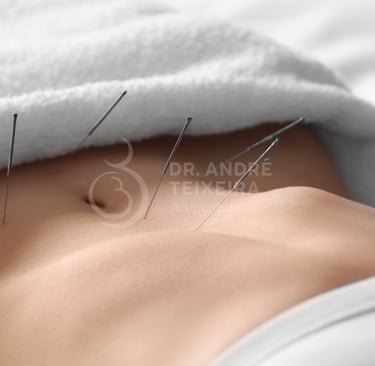 uma mulher com agulhas de acupuntura em barriga de mulher que deseja engravidar