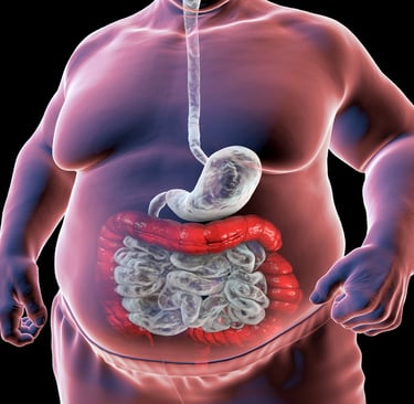 Fecal Microbiota Transplantation (FMT): A Promising Solution for Metabolic Syndrome 