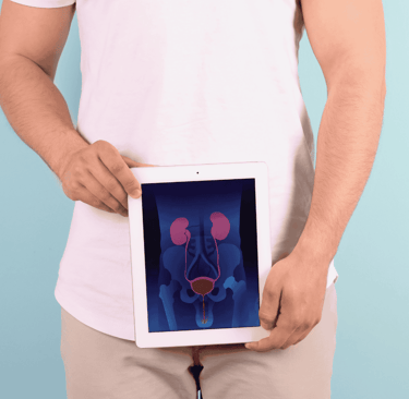 imagen de un hombre que se hizo una prueba genética para detectar el cáncer y aparece con una radiografía