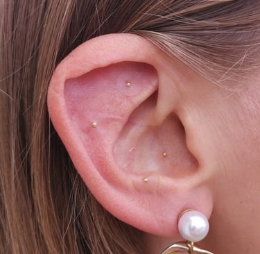 acupuncture phoenix, electro-acupuncture, EAN therapy, auriculotherapy, gold ear seeds, holistic