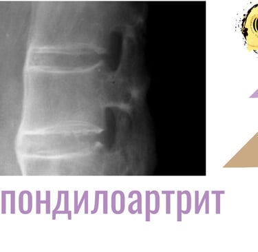 Спондилоартир снимка