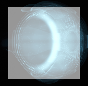 Flashes & Floaters a picture of an x-rayed eye
