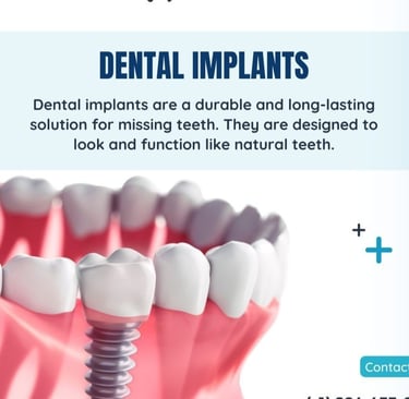 Boring digital marketing for dental implants